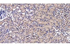 Detection of MAP2K7 in Mouse Kidney Tissue using Polyclonal Antibody to Mitogen Activated Protein Kinase Kinase 7 (MAP2K7) (MAP2K7 anticorps  (AA 113-388))