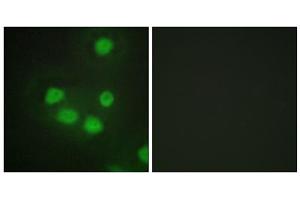 Immunofluorescence analysis of HepG2 cells, using SIX6 antibody. (SIX Homeobox 6 anticorps  (Internal Region))
