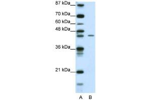 WB Suggested Anti-ZNF17 Antibody Titration: 0. (ZNF17 anticorps  (N-Term))