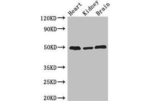 Western Blot Positive WB detected in: Mouse heart tissue, Mouse kidney tissue, Mouse brain tissue All lanes: ANKRD10 antibody at 4 μg/mL Secondary Goat polyclonal to rabbit IgG at 1/50000 dilution Predicted band size: 45, 24 kDa Observed band size: 50 kDa (ANKRD1 anticorps  (AA 1-220))
