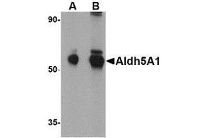 Western blot analysis of Aldh5A1 in mouse liver lysate with AP30045PU-N Aldh5A1 antibody at (A) 1 and (B) 2 μg/ml. (ALDH5A1 anticorps  (C-Term))