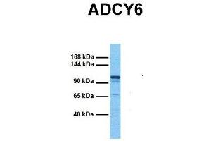 Host:  Rabbit  Target Name:  ADCY6  Sample Tissue:  Human Fetal Kidney  Antibody Dilution:  1. (ADCY6 anticorps  (C-Term))