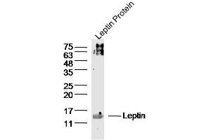 Leptin lysates probed with Leptin Polyclonal Antibody, Unconjugated  at 1:300 dilution and 4˚C overnight incubation. (Leptin anticorps  (AA 17-100))