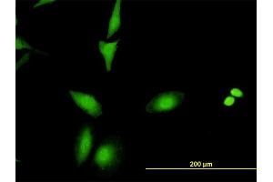 Immunofluorescence of monoclonal antibody to CRADD on HeLa cell. (CRADD anticorps  (AA 1-199))