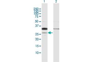 Western Blot analysis of PPAP2A expression in transfected 293T cell line by PPAP2A MaxPab polyclonal antibody. (PPAP2A anticorps  (AA 1-284))