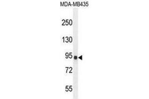 Western blot analysis in MDA-MB435 cell line lysates (35ug/lane) using IL12RB2  Antibody .