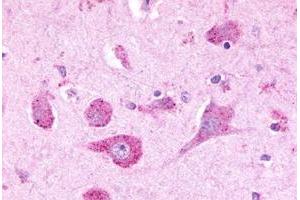 Immunohistochemical staining of human brain, neurons with LPHN3 polyclonal antibody . (LPHN3 anticorps  (C-Term))