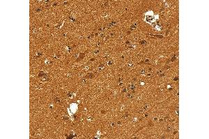 IHC analysis of VCP using anti-VCP antibody (ABIN7599605).