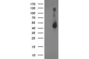 Western Blotting (WB) image for anti-Ganglioside-Induced Differentiation-Associated Protein 1-Like 1 (GDAP1L1) antibody (ABIN1498421) (GDAP1L1 anticorps)