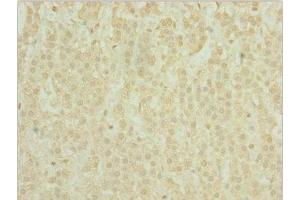 Immunohistochemistry of paraffin-embedded human adrenal gland tissue using ABIN7163721 at dilution of 1:100 (POC1A anticorps  (AA 138-407))