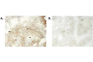 Immunohistochemical staining of bioptic sections of small intestine using anti-NLRP6/NALP6 (human), mAb (Clint-1)  at 1:500 dilution. (NLRP6 anticorps)