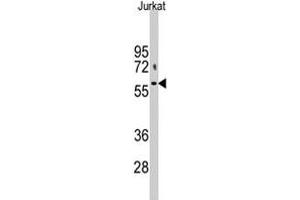 Western blot analysis of PFKFB1 polyclonal antibody  in Jurkat cell lysate (35 ug/lane). (PFKFB1 anticorps  (N-Term))