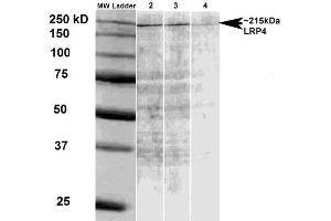 Western Blot analysis of Rat brain membrane lysate showing detection of LRP4 protein using Mouse Anti-LRP4 Monoclonal Antibody, Clone S207-27 . (LRP4 anticorps  (AA 26-350) (Atto 390))