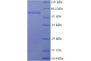 SDS-PAGE (SDS) image for Myeloproliferative Leukemia Virus Oncogene (MPL) (AA 26-491), (Extracellular) protein (His tag) (ABIN5709953) (MPL Protein (AA 26-491, Extracellular) (His tag))