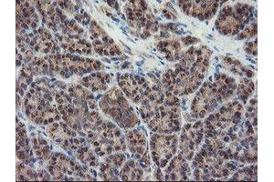 Image no. 3 for anti-Diphthamide Biosynthesis Protein 2 (DPH2) antibody (ABIN1497893) (DPH2 anticorps)