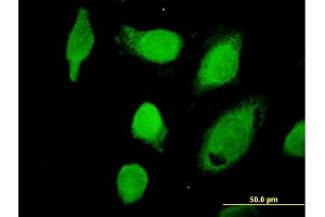 Immunofluorescence of purified MaxPab antibody to CAPN1 on HeLa cell. (CAPNL1 anticorps  (AA 1-714))