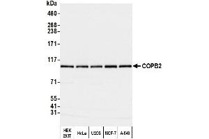Western Blotting (WB) image for anti-Coatomer Protein Complex, Subunit beta 2 (COPB2) (AA 856-906) antibody (ABIN7453569)