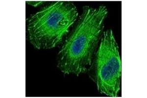 Immunofluorescence (IF) image for anti-Forkhead Box O1 (FOXO1) antibody (ABIN1107270)
