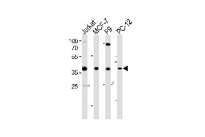 Western blot analysis of lysates from Jurkat, MCF-7, F9, PC-12 cell line (from left to right), using human-FOSL2 (Y83) (ABIN6243663 and ABIN6577541). (FOSL2 anticorps  (AA 70-110))
