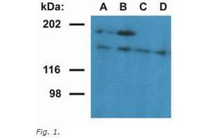 Western Blotting (WB) image for anti-Ubinuclein 1 (UBN1) (AA 1-190), (N-Term) antibody (ABIN614815) (Ubinuclein 1 anticorps  (N-Term))