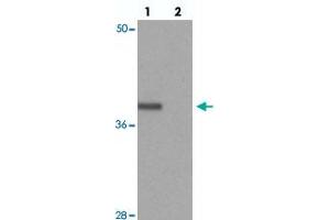 Western blot analysis of PRICKLE4 in A-549 cell lysate with PRICKLE4 polyclonal antibody  at 0. (PRICKLE4 anticorps  (N-Term))