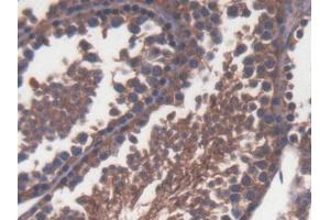 DAB staining on IHC-P; Samples: Mouse Testis Tissue (TLR1 anticorps  (AA 25-134))
