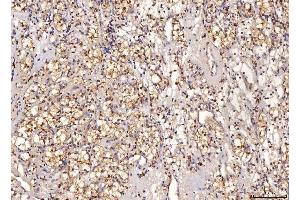 IHC analysis of Sorbitol Dehydrogenase/SORD using anti-Sorbitol Dehydrogenase/SORD antibody (ABIN7602485).