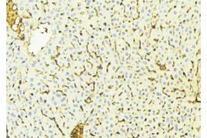 ABIN6269022 at 1/100 staining Mouse liver tissue by IHC-P. (VDAC1 anticorps  (C-Term))