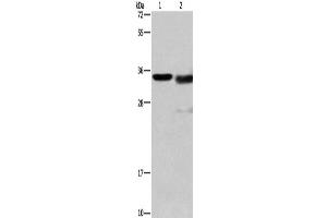 Western Blotting (WB) image for anti-Cathepsin L1 (CTSL1) antibody (ABIN2427905) (Cathepsin L anticorps)