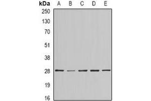 Western blot analysis of BAP29 expression in SKOV3 (A), MCF7 (B), mouse testis (C), mouse brain (D), rat heart (E) whole cell lysates. (BCAP29 anticorps)