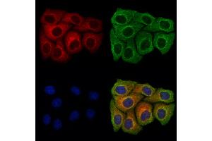 ABIN7094552 and ABIN7098601 staining Hela cells by IF/ICC.