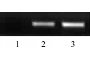 Specificity Data: Dot blot analysis was used to confirm the specificity of 39123 for acetyl-Lys5 of histone H2B.