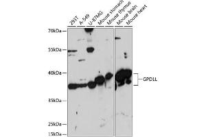 Western blot analysis of extracts of various cell lines, using GPD1L antibody (ABIN7267460) at 1:3000 dilution. (GPD1L anticorps  (AA 1-351))