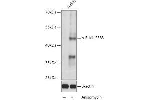 Western blot analysis of extracts of Jurkat cells, using Phospho-ELK1-S383 antibody (ABIN3019475, ABIN3019476, ABIN3019477 and ABIN6225392) at 1:1000 dilution. (ELK1 anticorps  (pSer383))