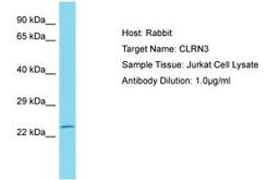 Image no. 1 for anti-Clarin 3 (CLRN3) (AA 151-200) antibody (ABIN6750827)