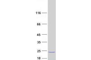 Validation with Western Blot