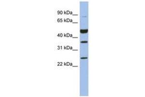 Image no. 1 for anti-Melanoma Antigen Family B, 3 (MAGEB3) (AA 35-84) antibody (ABIN6744053) (MAGEB3 anticorps  (AA 35-84))