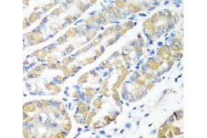 Immunohistochemistry of paraffin-embedded Human stomach using MSRB2 Polyclonal Antibody at dilution of 1:100 (40x lens). (MSRB2 anticorps)