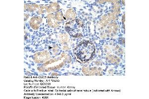 Human kidney (CLIC5 anticorps  (C-Term))