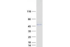 Validation with Western Blot