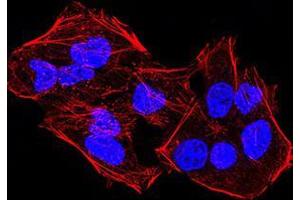 Immunofluorescence analysis of HeLa cells using KDM4A mouse mAb. (KDM4A anticorps  (AA 932-1057))