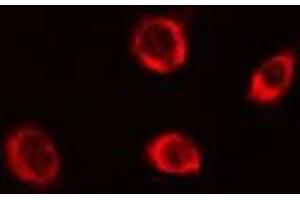 ABIN6279649 staining Hela cells by IF/ICC.