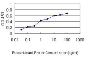 Detection limit for recombinant GST tagged ERBB2IP is approximately 0. (ERBB2IP anticorps  (AA 1272-1371))