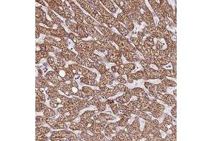 Immunohistochemical staining of human liver with LOC728597 polyclonal antibody ( Cat # PAB28327 ) shows strong cytoplasmic positivity in hepatocytes at 1:200 - 1:500 dilution. (DCDC2C anticorps)