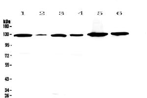 Western blot analysis of VEGF Receptor 1  using anti-VEGF Receptor 1  antibody . (FLT1 anticorps)