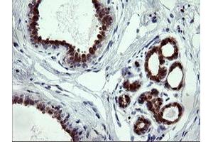 Image no. 2 for anti-Cytidine Monophosphate (UMP-CMP) Kinase 1, Cytosolic (CMPK1) antibody (ABIN1497544) (Cytidine Monophosphate (UMP-CMP) Kinase 1, Cytosolic (CMPK1) anticorps)