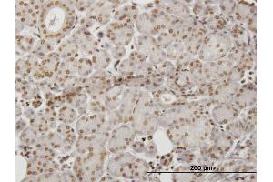 Immunoperoxidase of monoclonal antibody to HIPK1 on formalin-fixed paraffin-embedded human salivary gland. (HIPK1 anticorps  (AA 330-430))