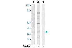 Western blot analysis of extracts from HUVEC cells (Lane 1 and lane 3) and COLO 205 cells (Lane 2), using SIX6 polyclonal antibody . (SIX Homeobox 6 anticorps)