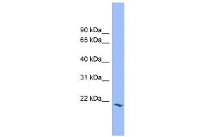 WB Suggested Anti-PRRG2 Antibody Titration:  0.