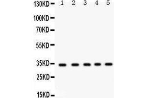 Western Blotting (WB) image for anti-Estrogen Receptor Binding Site Associated, Antigen, 9 (EBAG9) (AA 31-213) antibody (ABIN3043569) (RCAS1 anticorps  (AA 31-213))